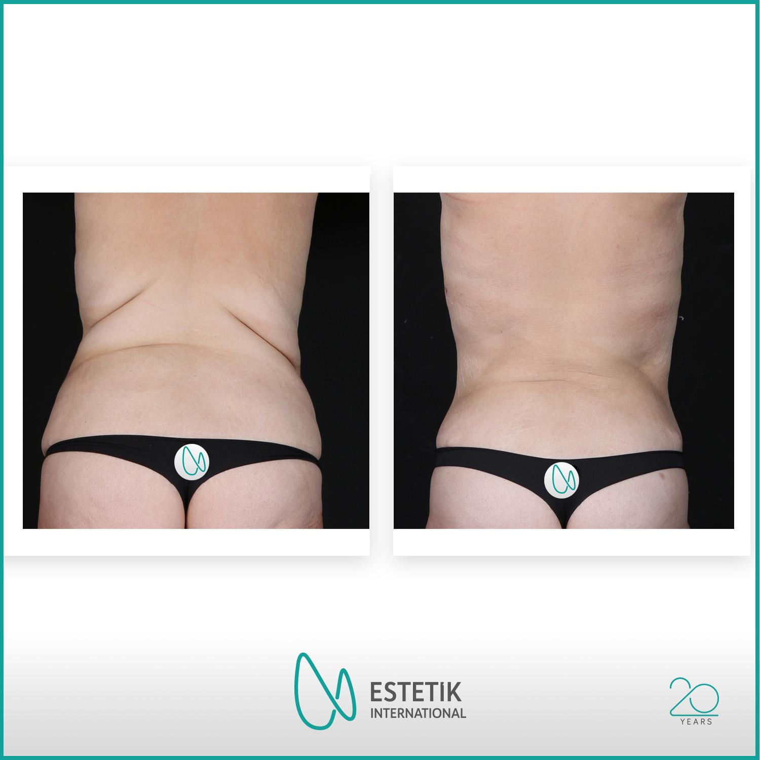 Estetik international results24