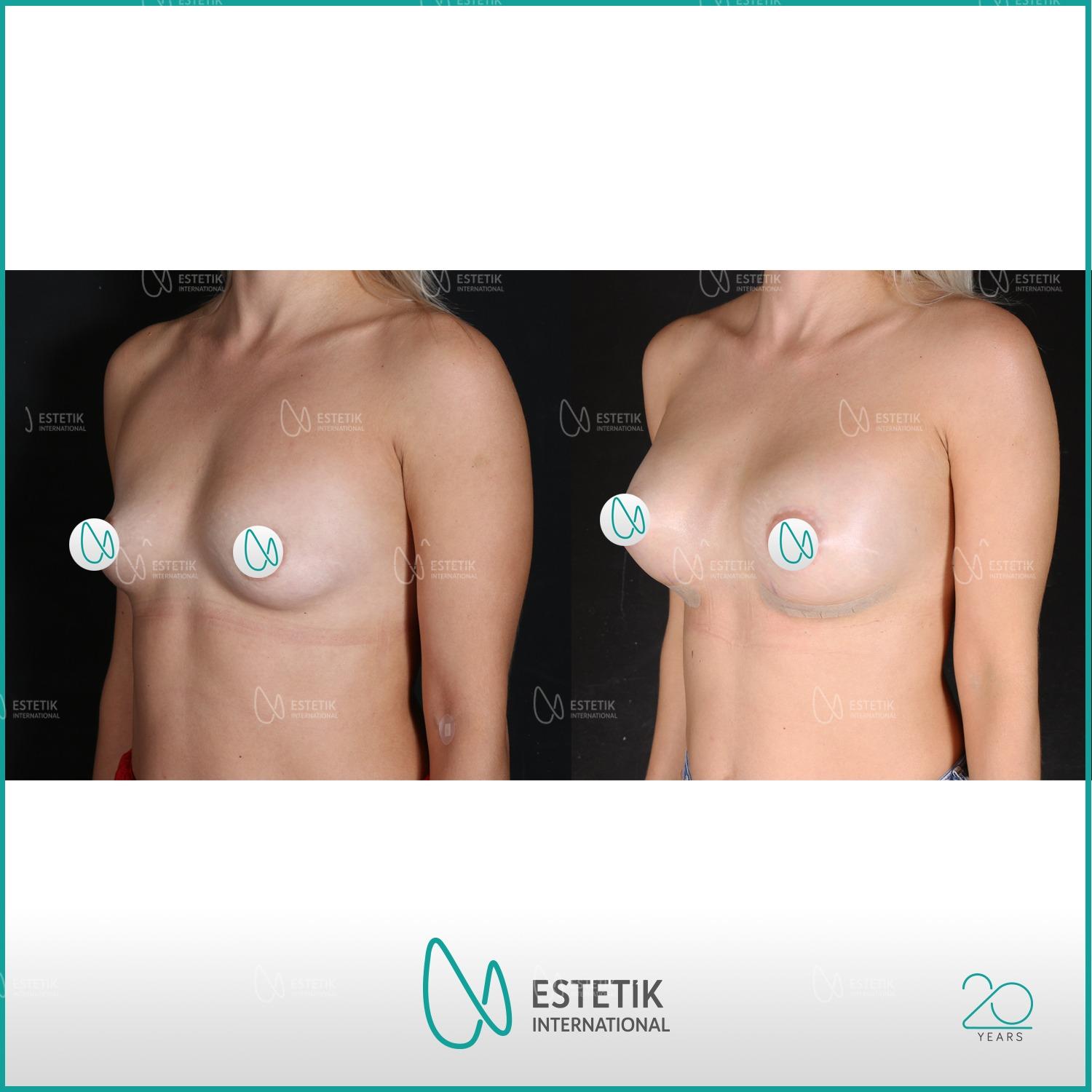 Estetik international results34