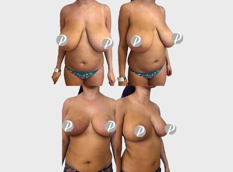 liftingseins-3-min