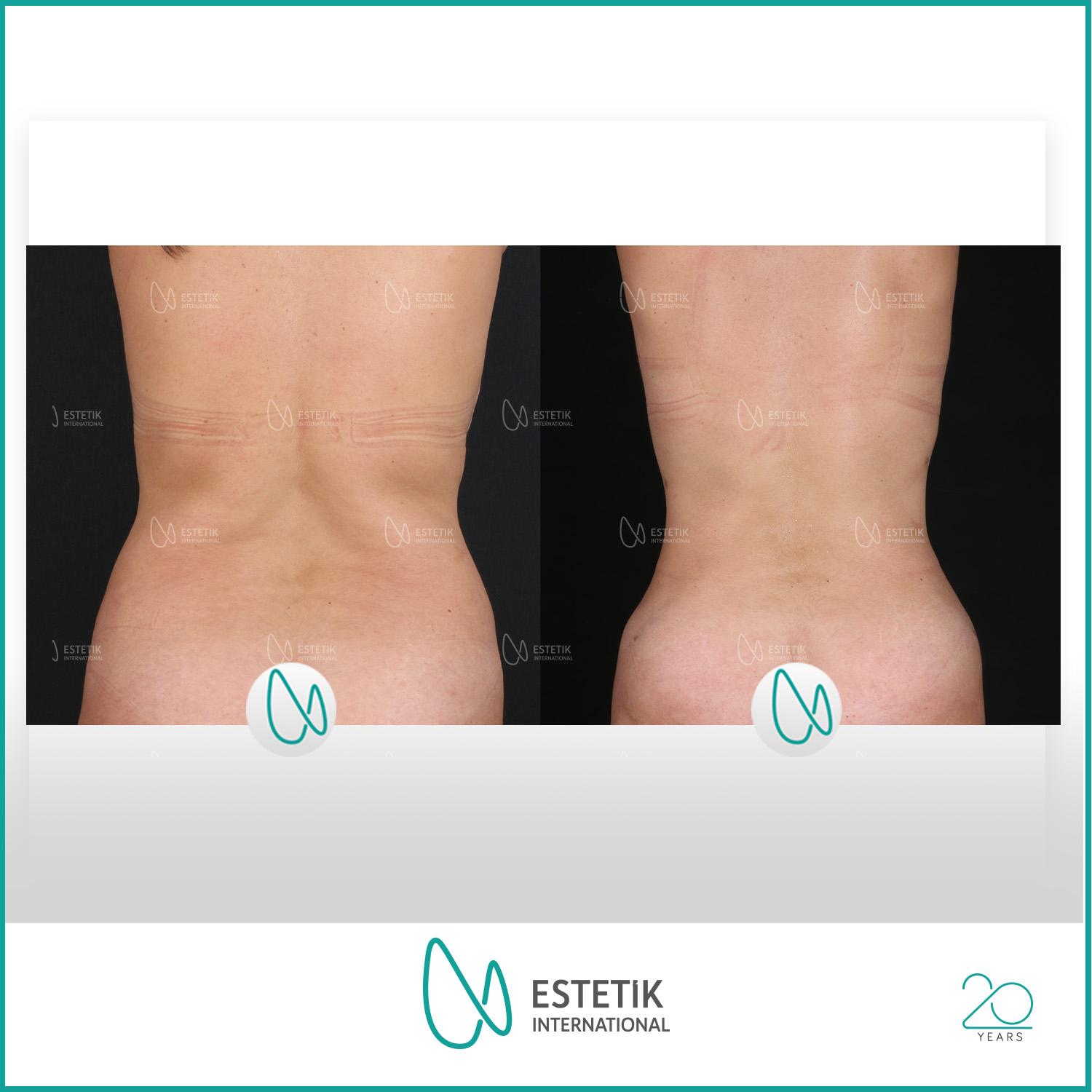 Estetik international results7