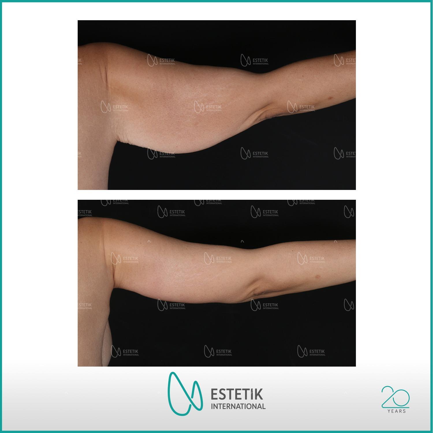 Estetik international results26