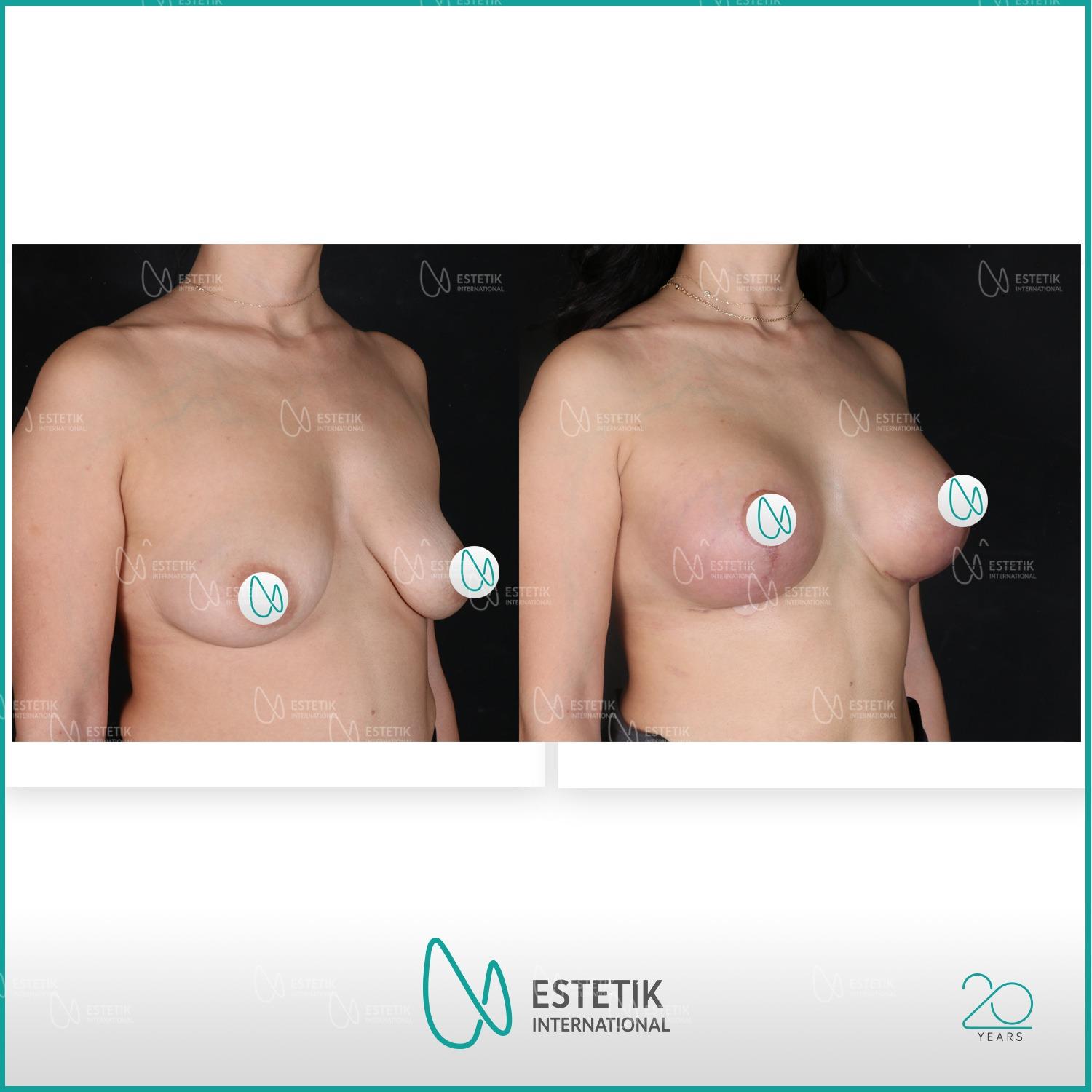 Estetik international results