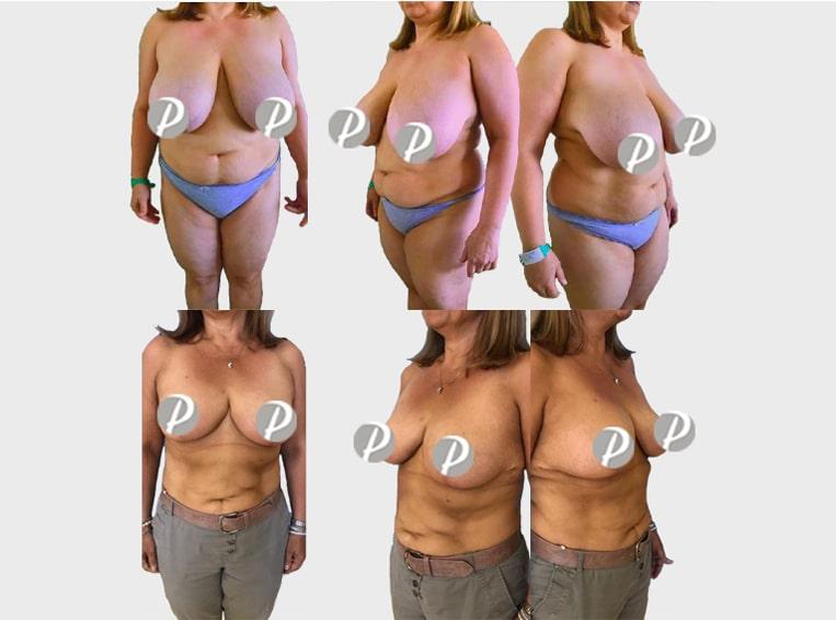 liftingseins-1-min