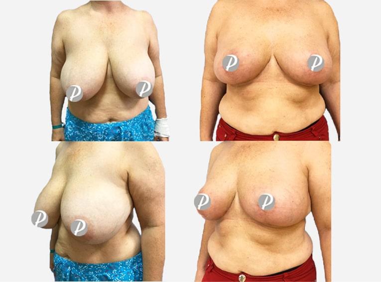 liftingseins-4-min