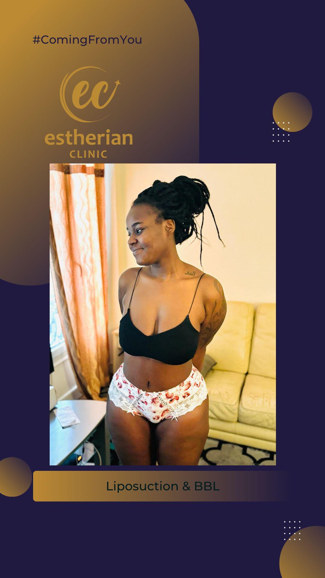 estherian BODY Surgery 6-min