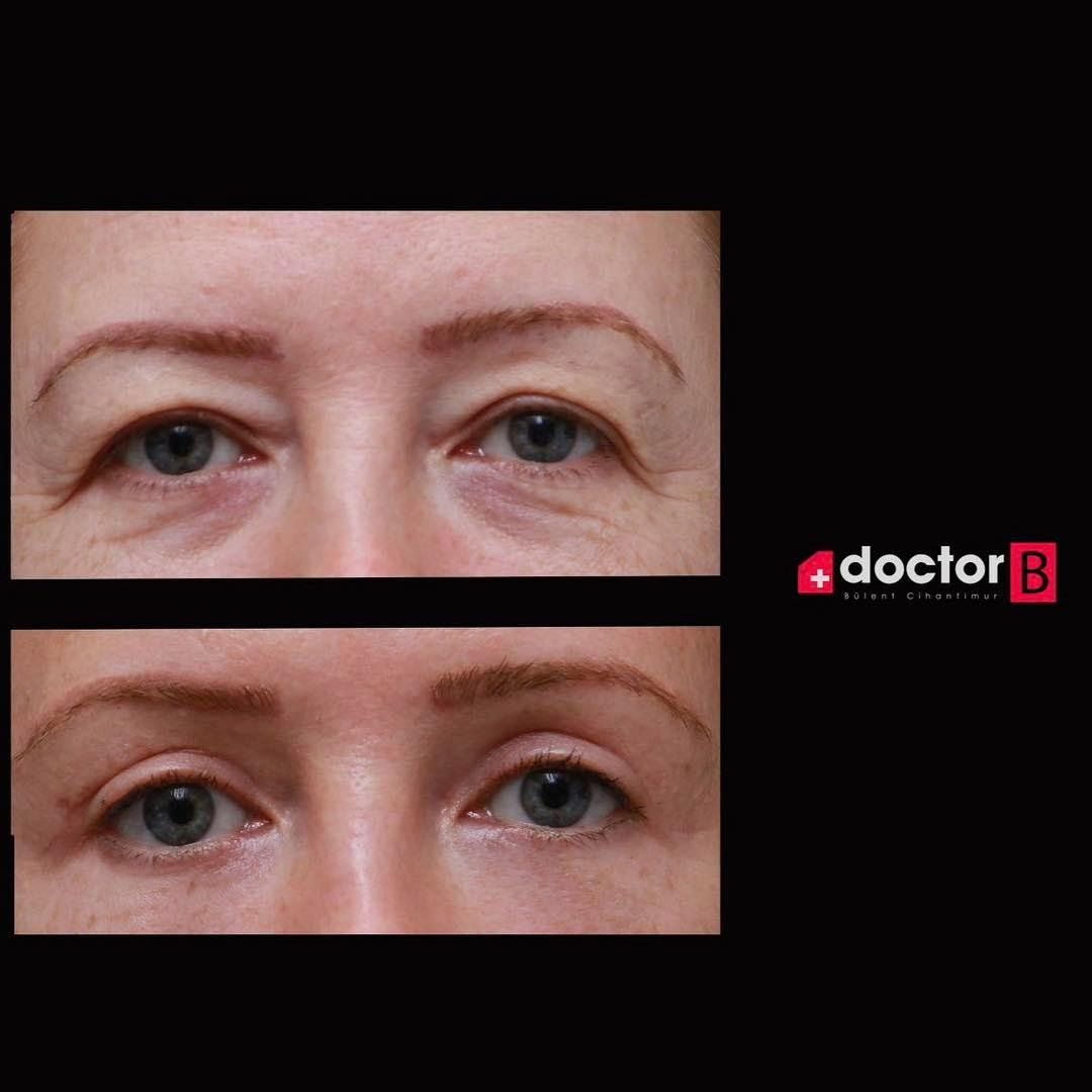 Estetik international results70