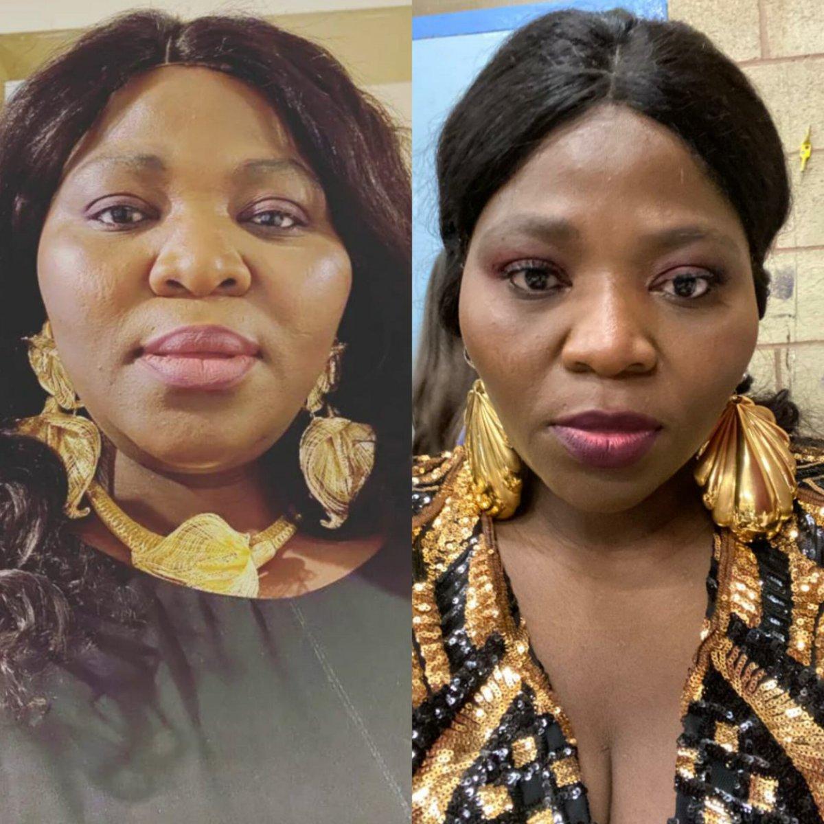 Istanbul weight loss