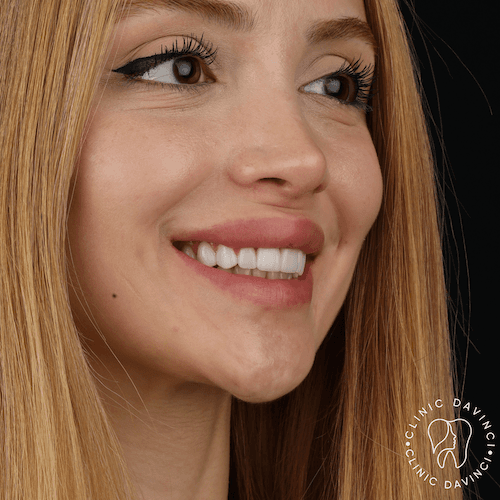 DA VINCI DENTAL RESULTS3