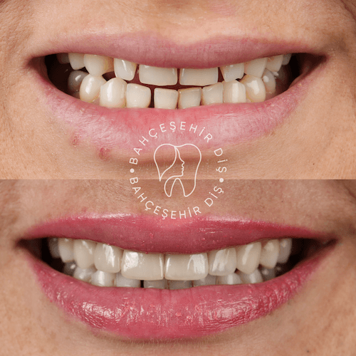 DA VINCI DENTAL RESULTS17