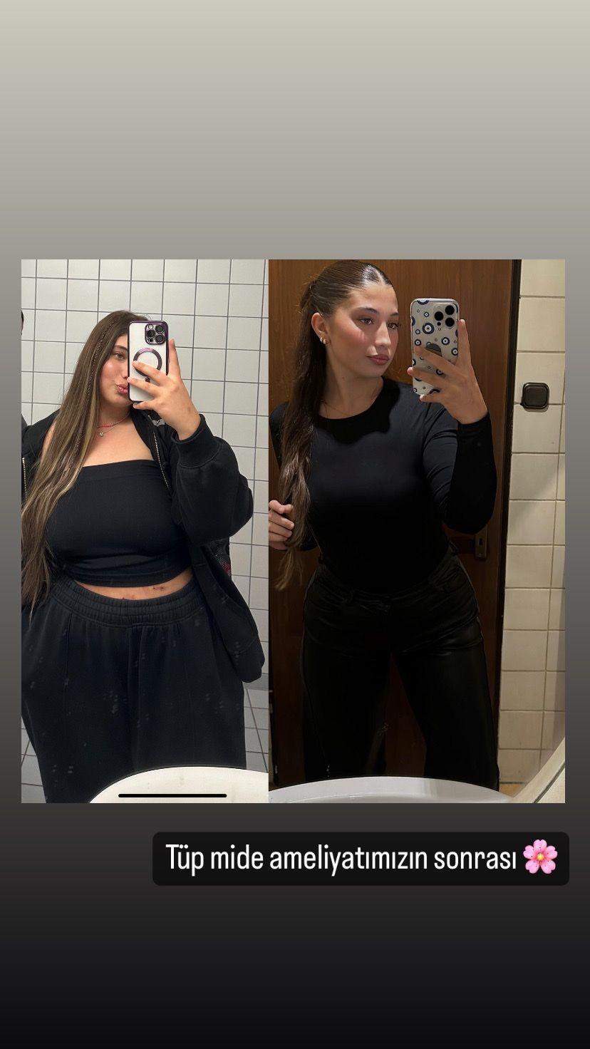 Dr Aylin Hande Gokce - Weight Loss48