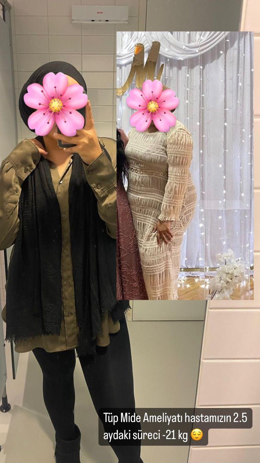 Dr Aylin Hande Gokce - Weight Loss49