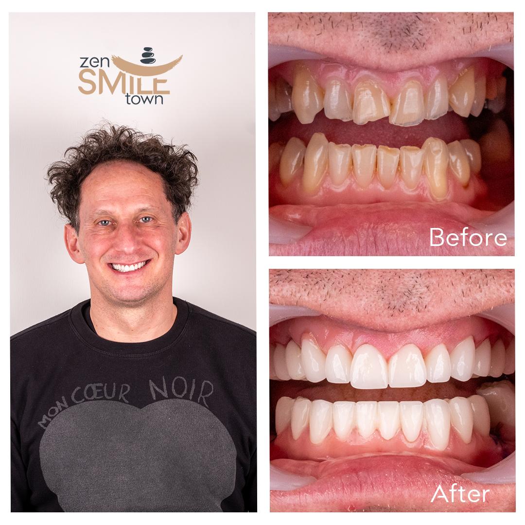 ZenSmileTown Dental Results27