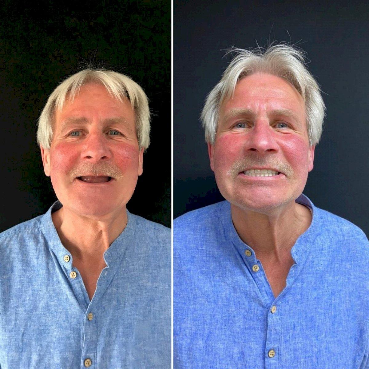 Ephesus dental results1