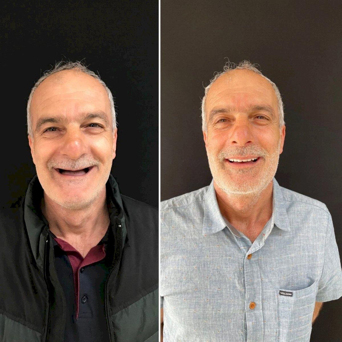 Ephesus dental results2