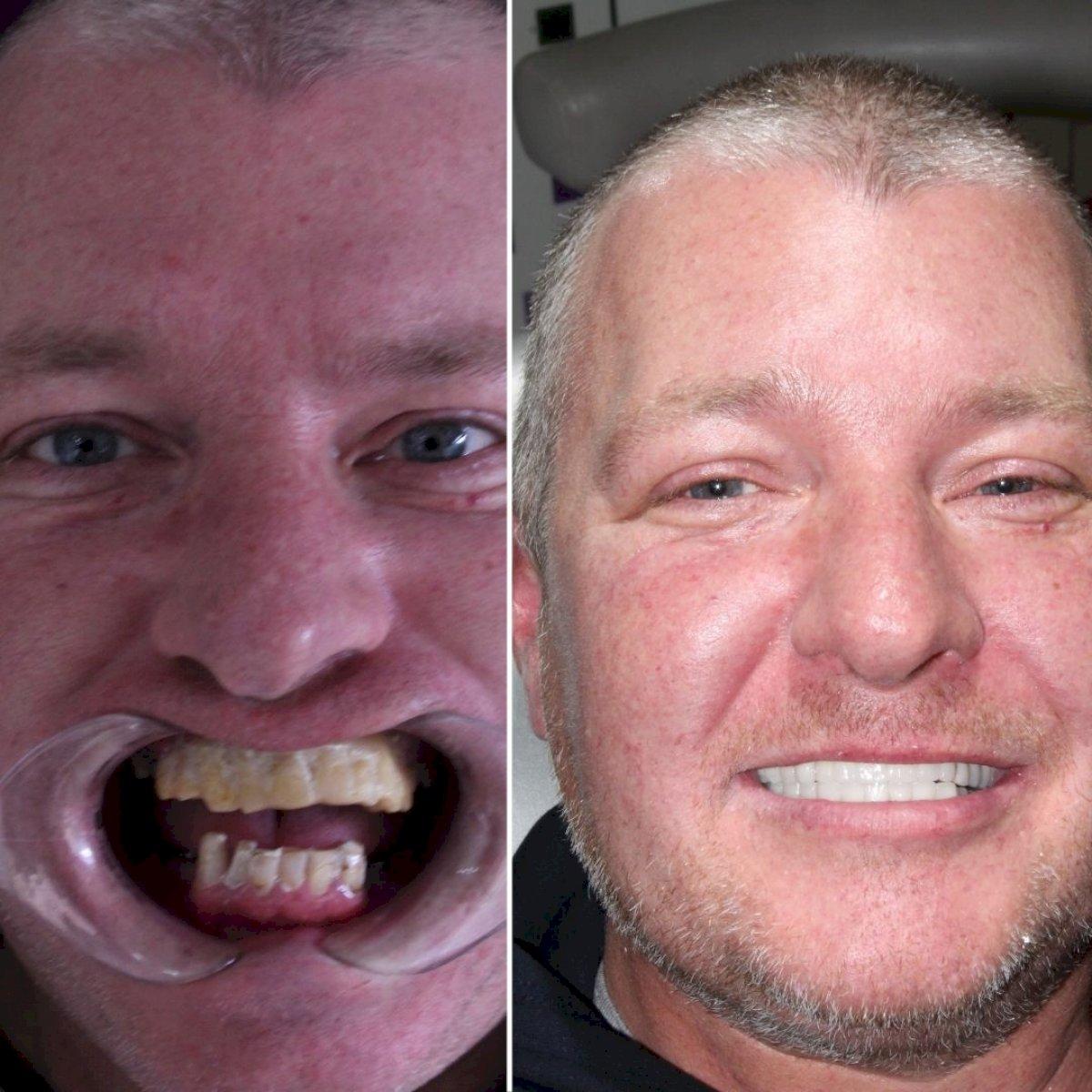 Ephesus dental results4