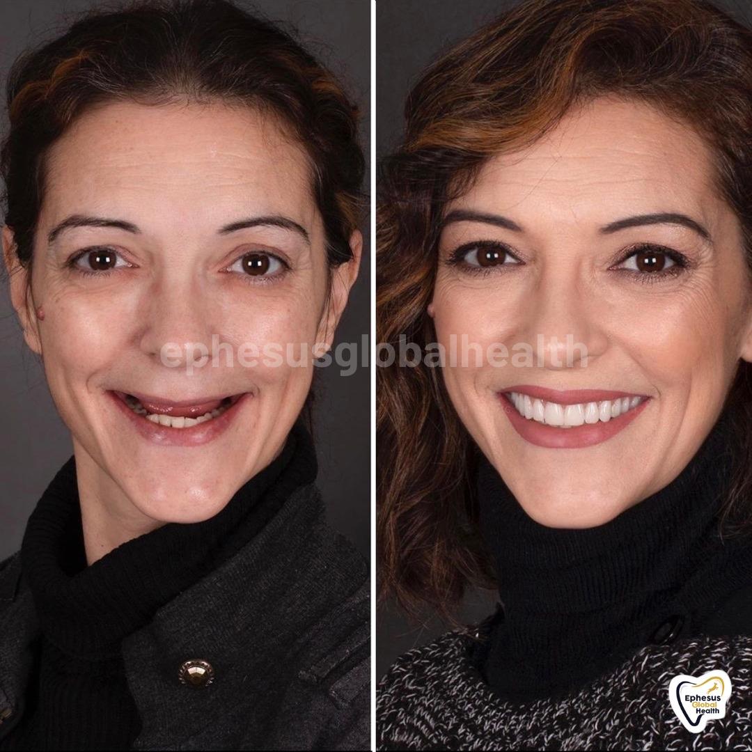 Ephesus dental results12