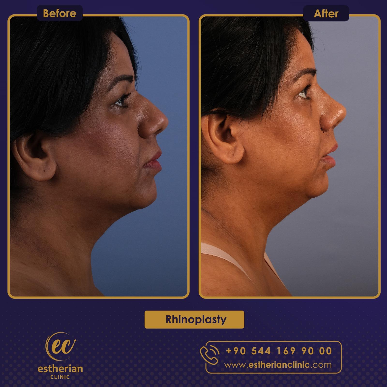 estherian Face Surgery 4