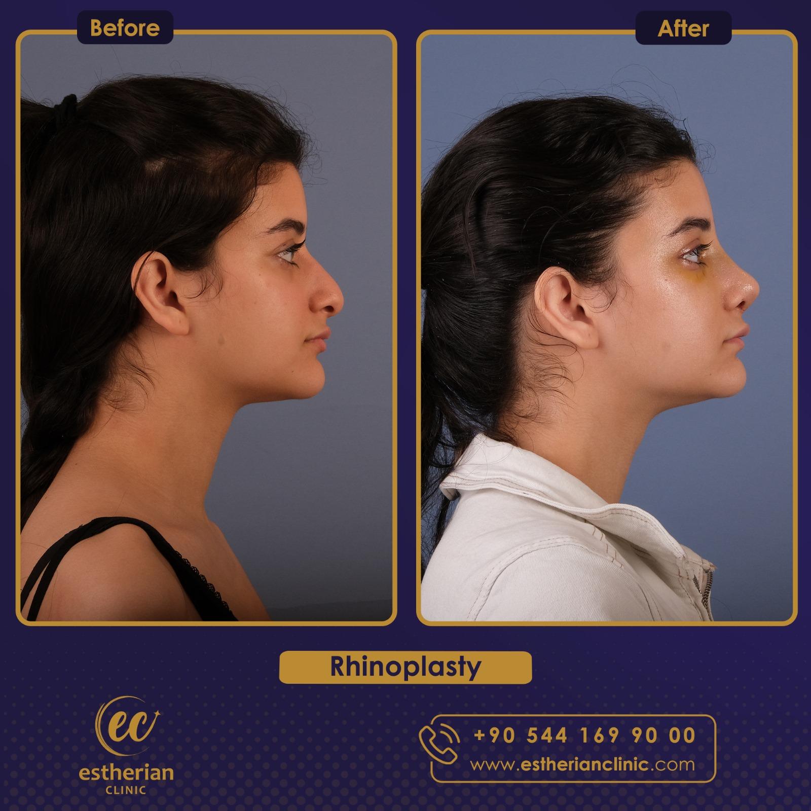 estherian Face Surgery 6