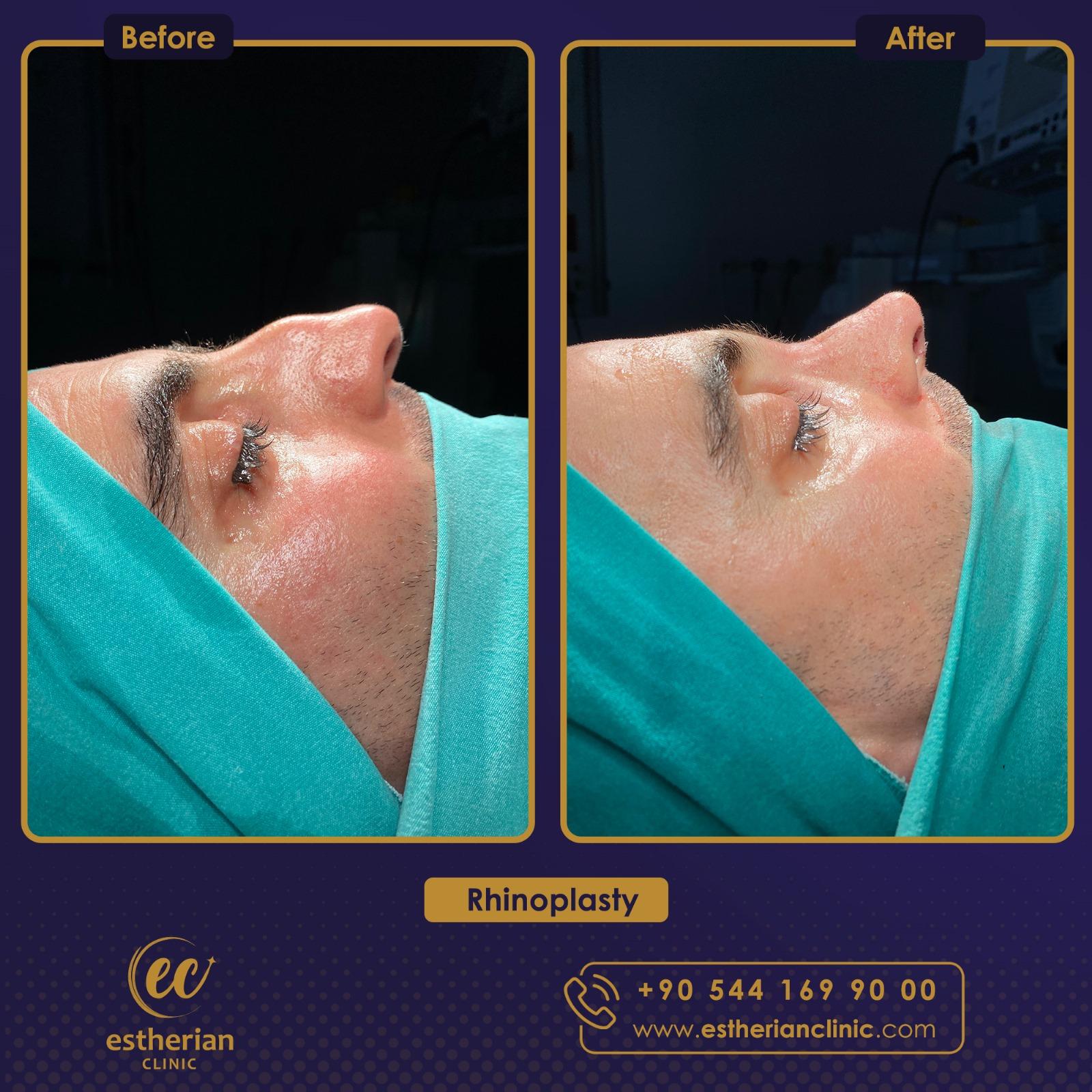 estherian Face Surgery 7