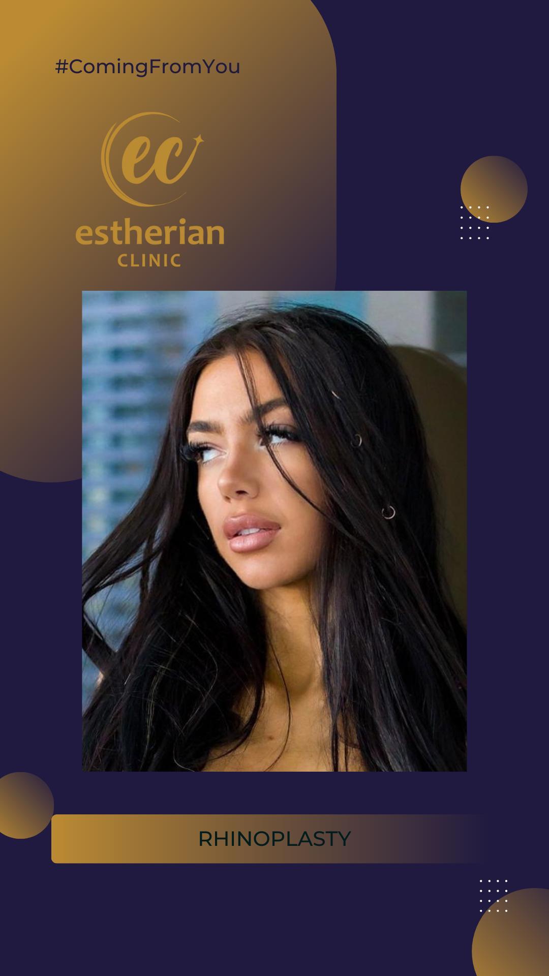 estherian Face Surgery 13-min