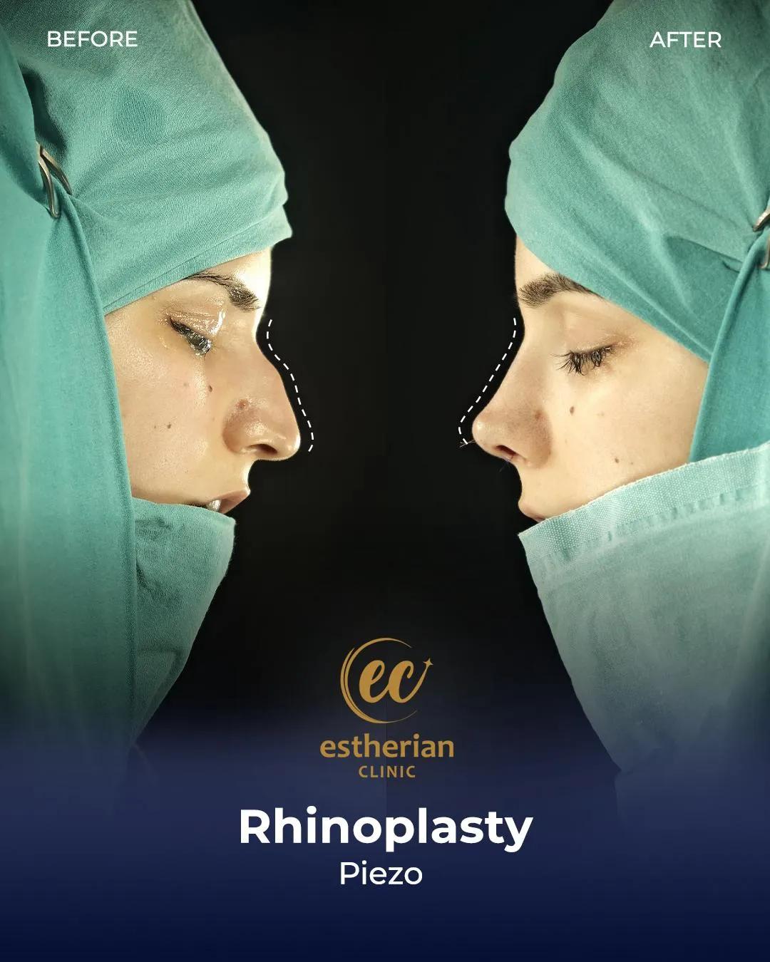 Estherian Clinic Istanbul results1