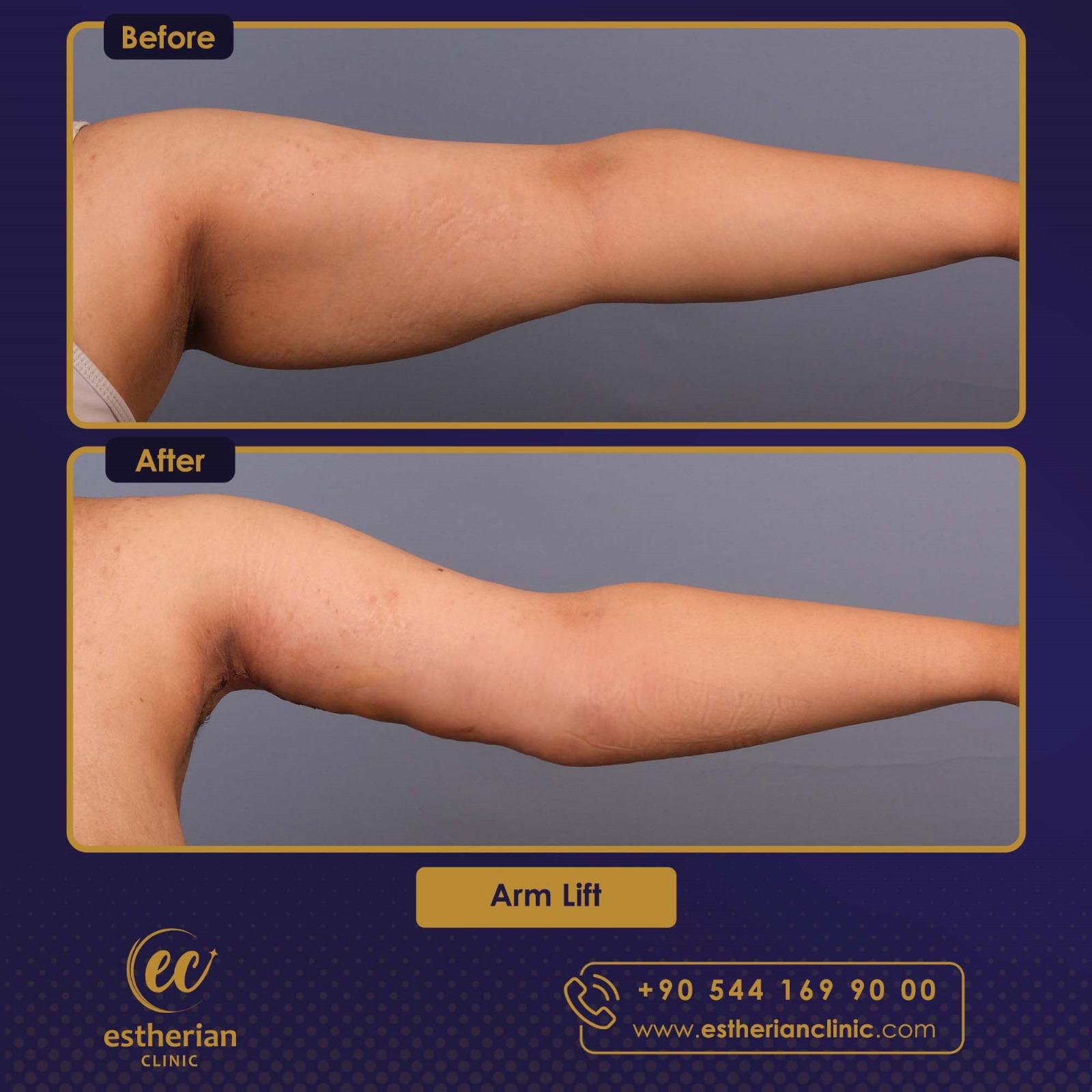 5739c421Estherian Istanbul on Esthetic Planetfb8b6e5c13ad85f37709c4e06d31ba4e