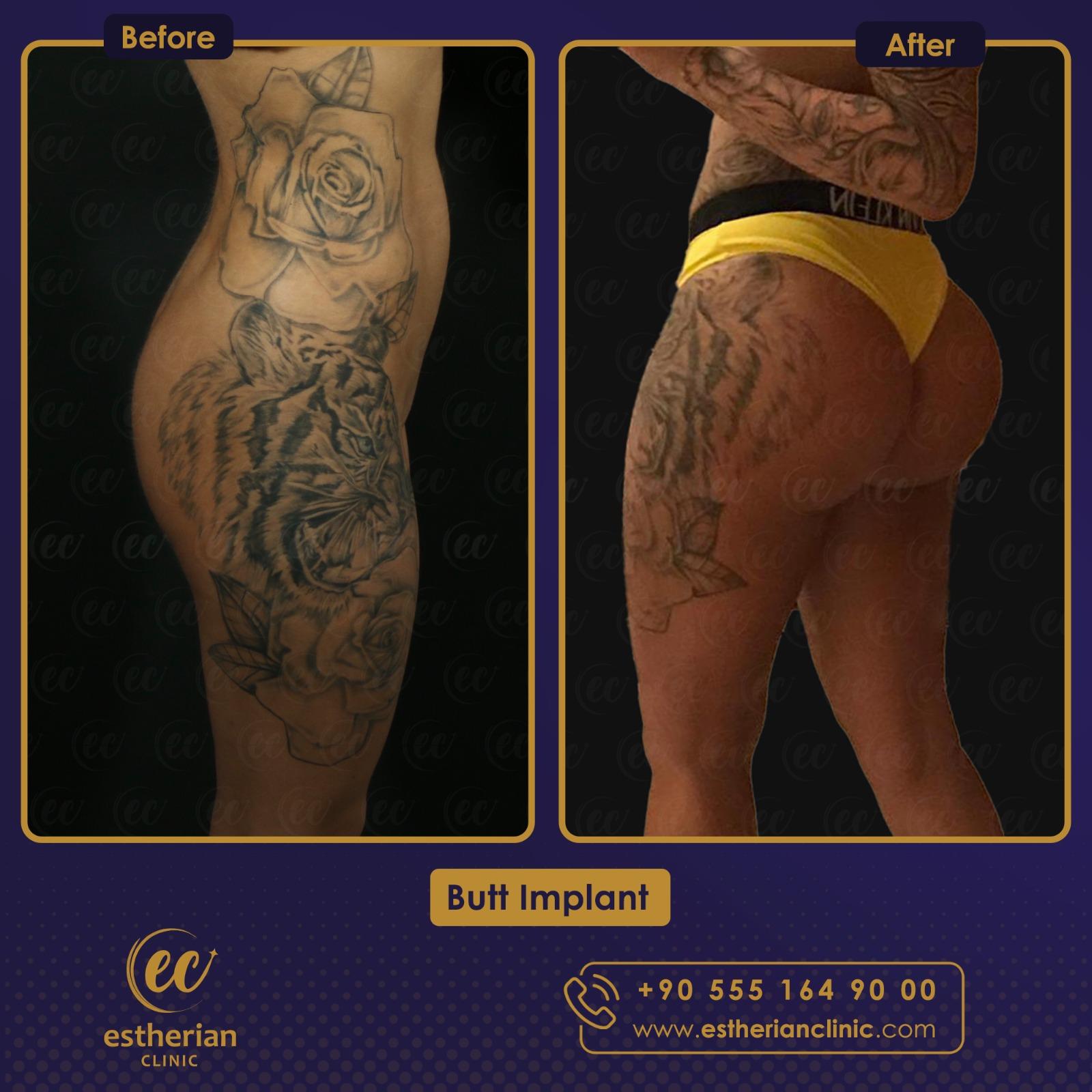 Estherian Istanbul on Esthetic Planet