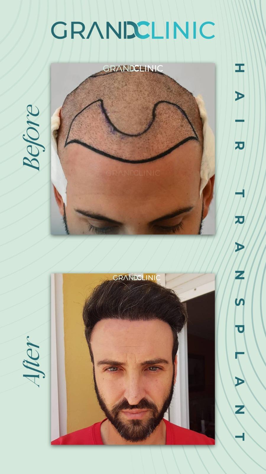 219d14f5-1c92-4a56-94ad-4914d96bed9d