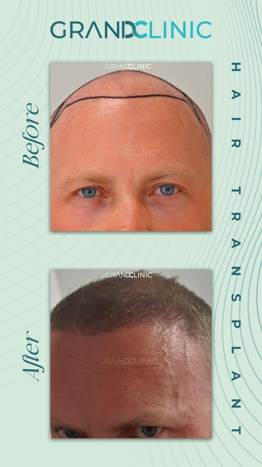 bbaff625-f756-41a0-910e-8493f3139936