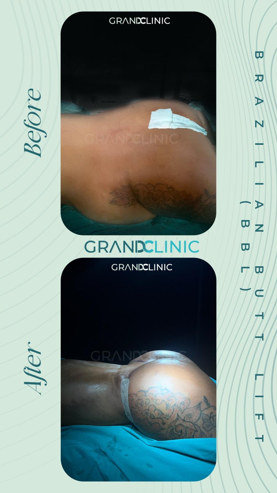 065098db-32d4-4490-a99c-d39ec6cdbd4e