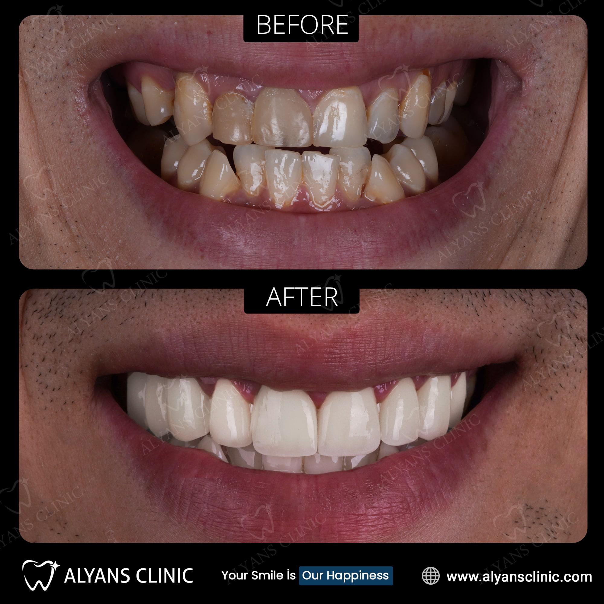 BEFORE=AFTER POST 2-min