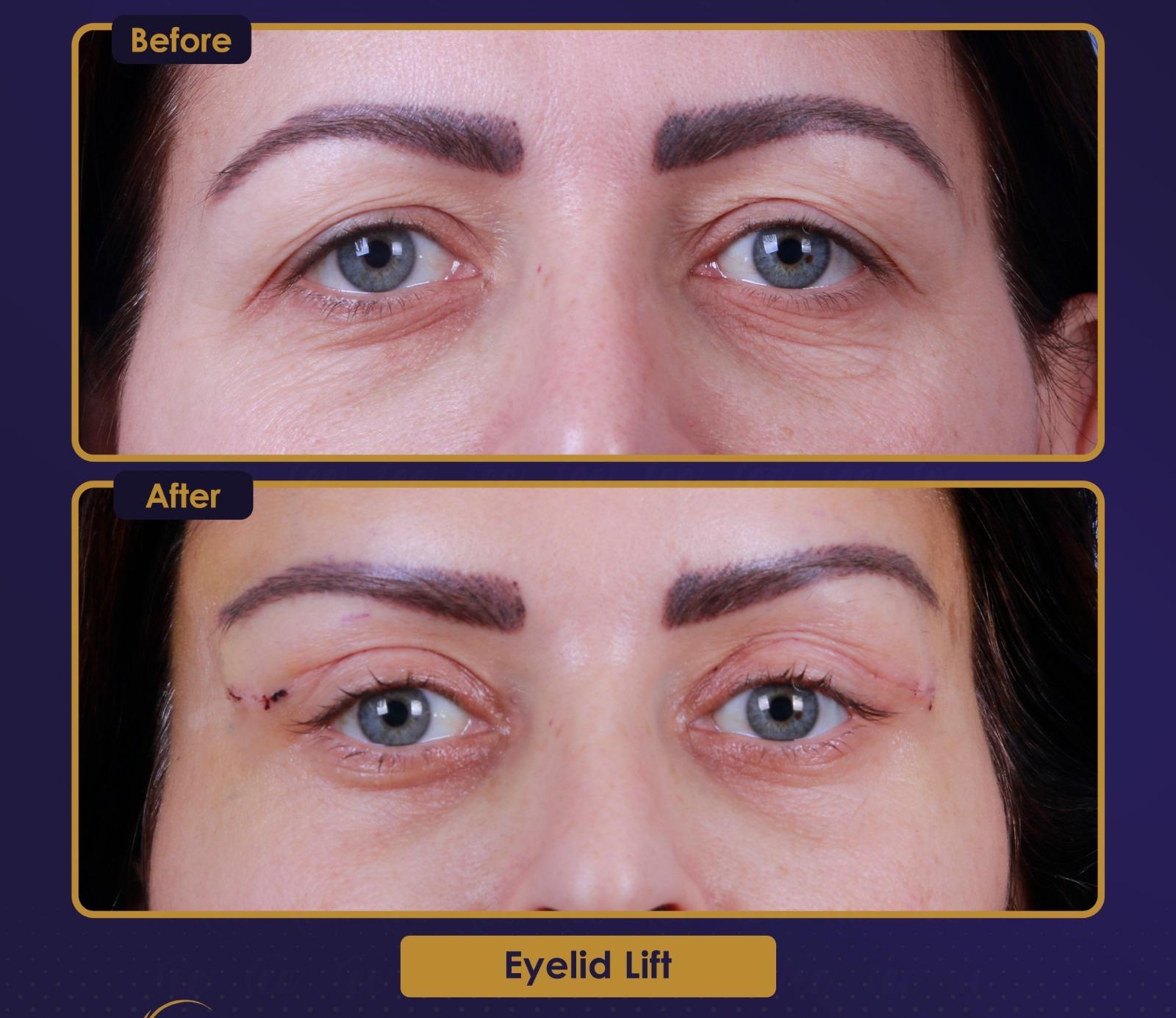 Résultat Estherian10