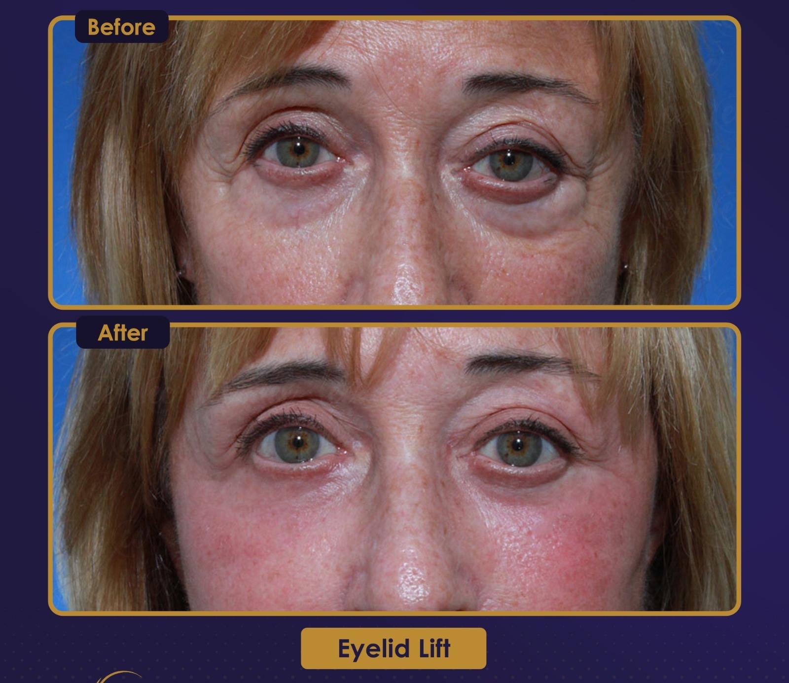 Résultat Estherian7