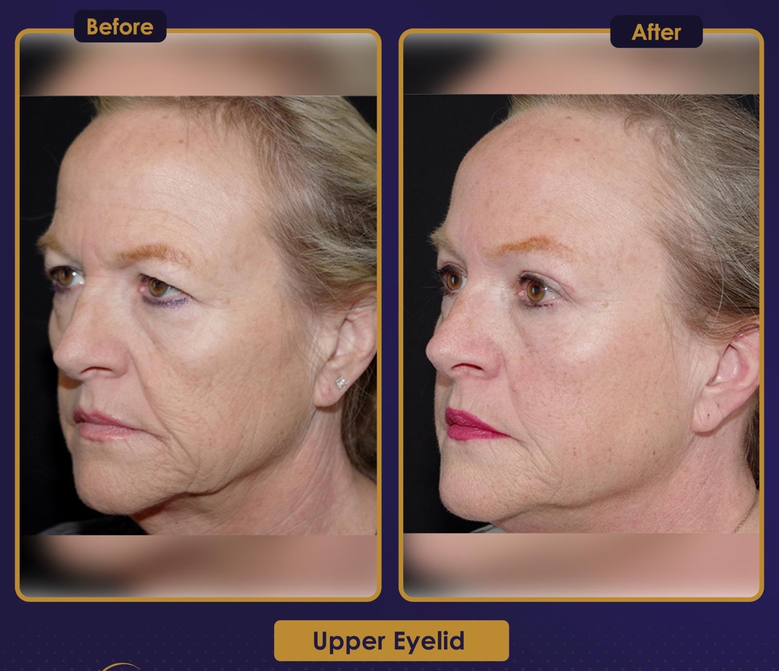 Résultat Estherian8