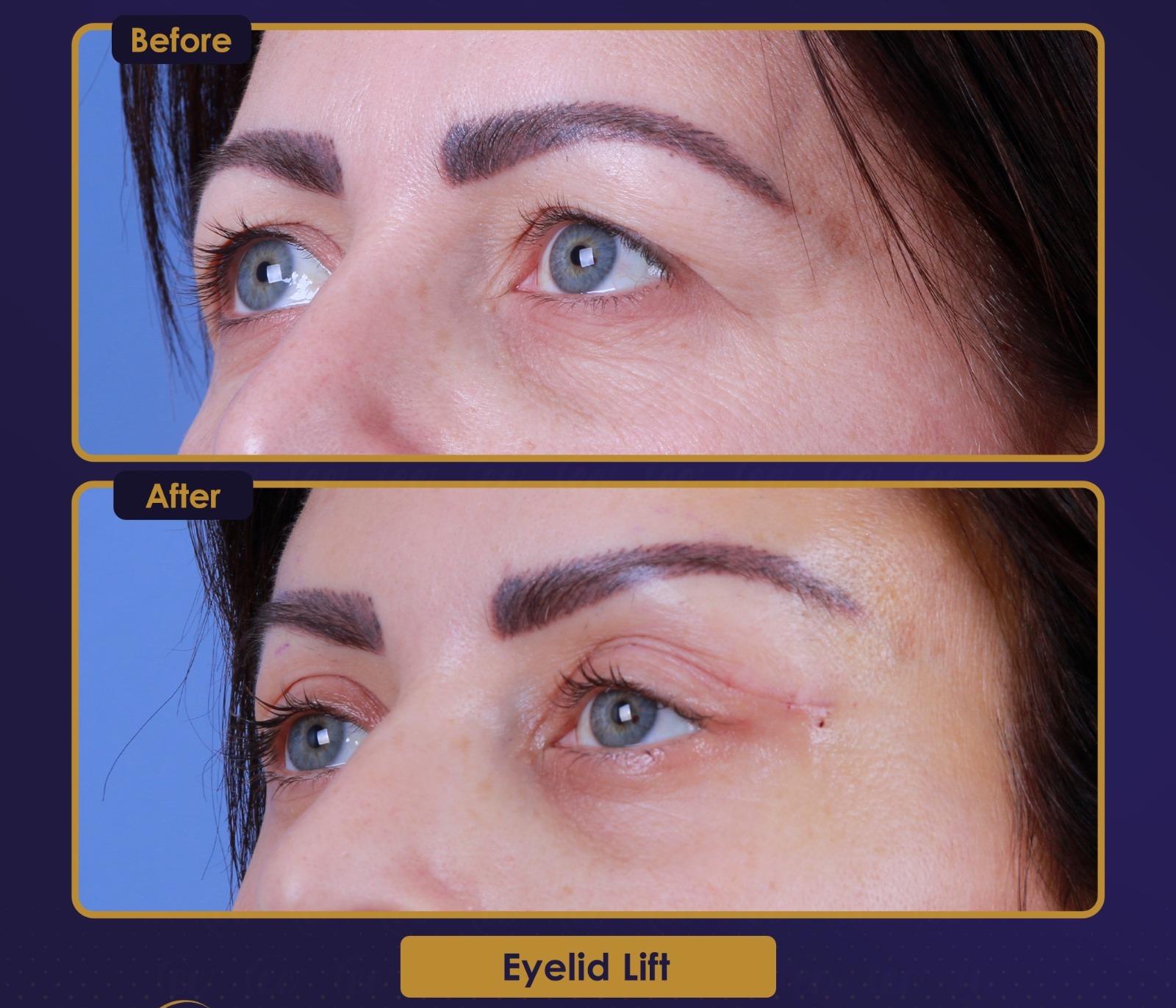 Résultat Estherian9