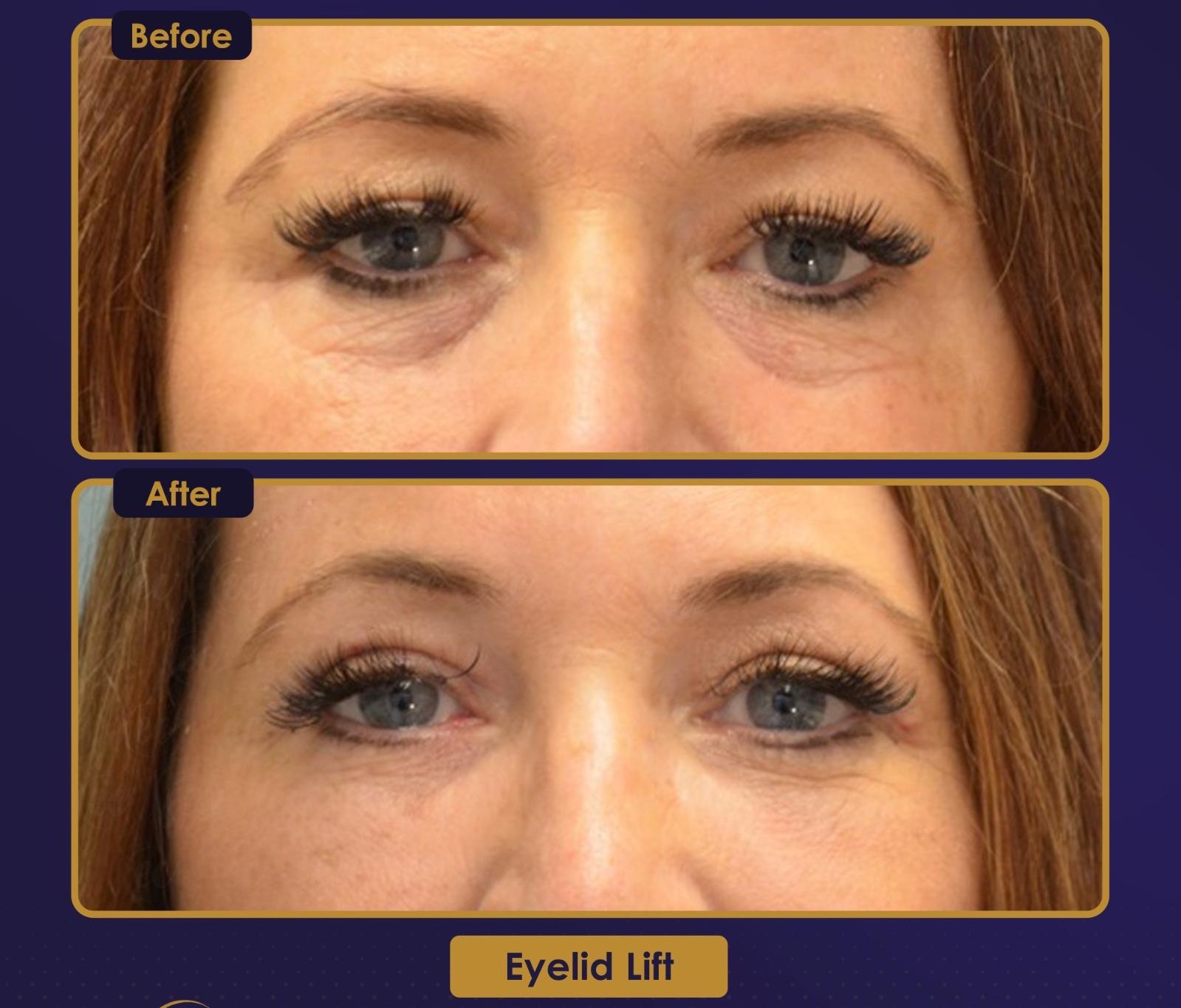 Résultat Estherian11