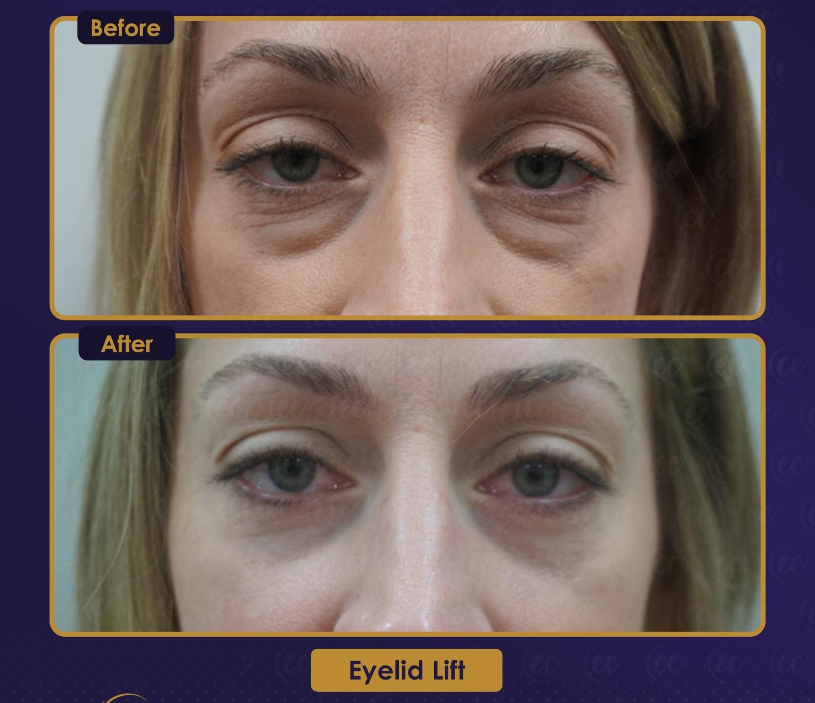 Résultat Estherian12