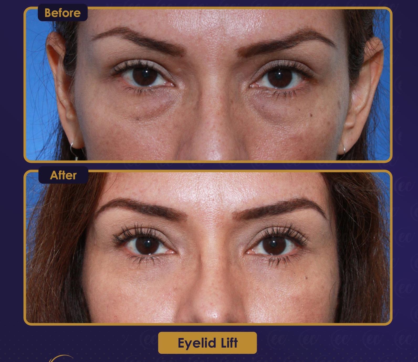 Résultat Estherian13