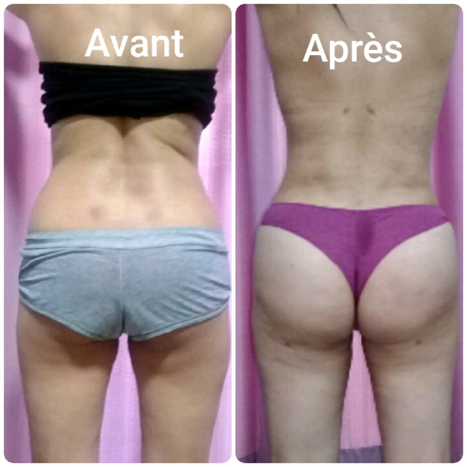 Zaghouan surgery results2