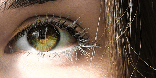 Blepharoplasty up and down