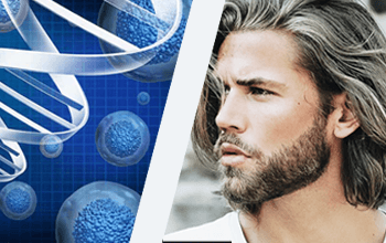 Stem Cells Hair Transplant