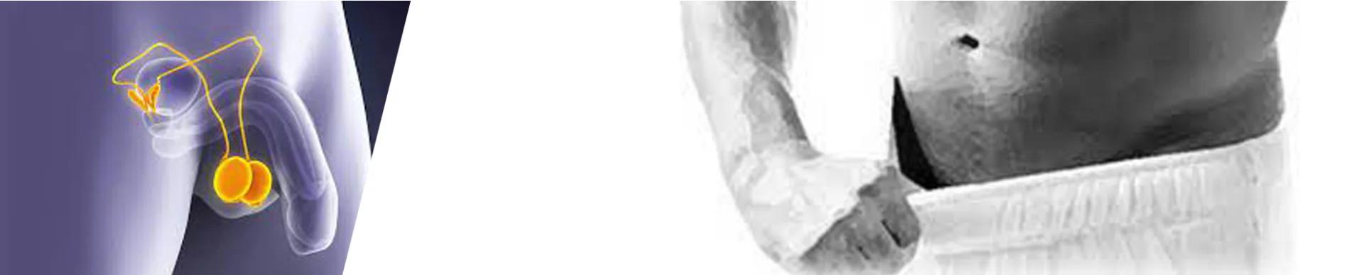 Testicular rejuvenation — Esthetic Planet