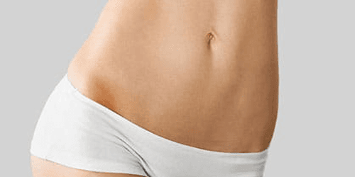 Tummy tuck