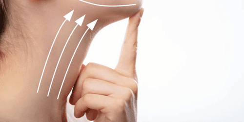 Neck Lift