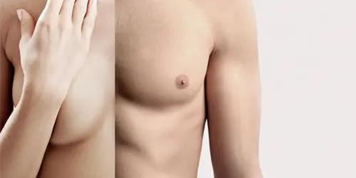 Réassignation De Genre (SRS)